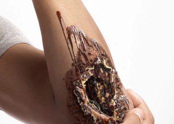 Impactante campaña contra la diabetes, por diseñador tailandés