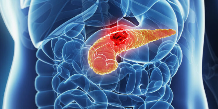 ¿Puede el SARS-CoV-2 dañar el páncreas y provocar diabetes? Esto dice científica mexicana