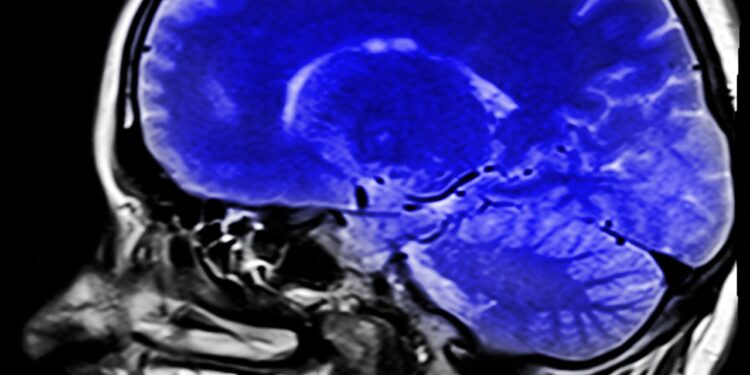 Investigadores mexicanos diseñan nueva tecnología para lograr mejores imágenes por resonancia magnética