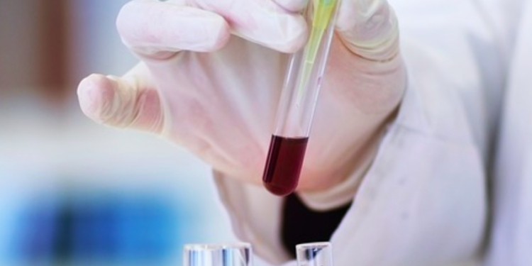 Solo se ha descubierto 0.1 por ciento de las enfermedades transmitidas de animales a humanos