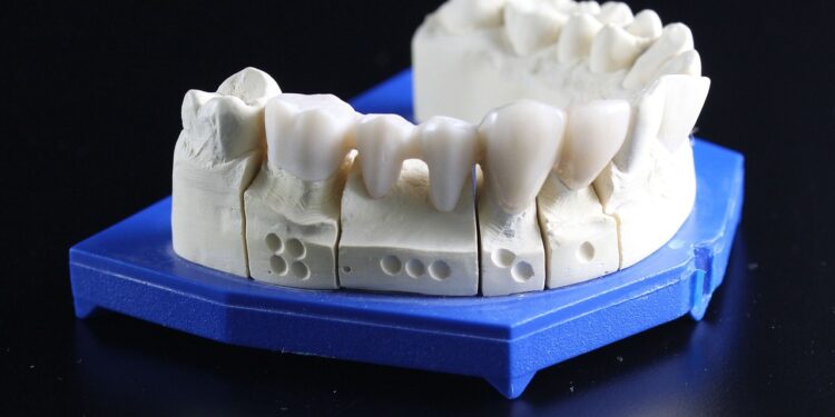 Rechinan los dientes 80 por ciento de los mexicanos
