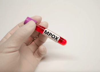 ¡Urgente! OMS declara la mpox una emergencia de salud pública internacional