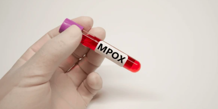 ¡Urgente! OMS declara la mpox una emergencia de salud pública internacional