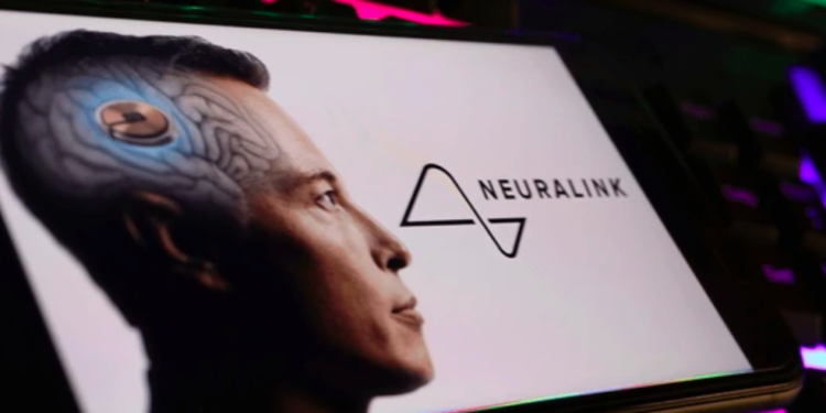 Revelan detalles del segundo paciente con un implante de Neuralink