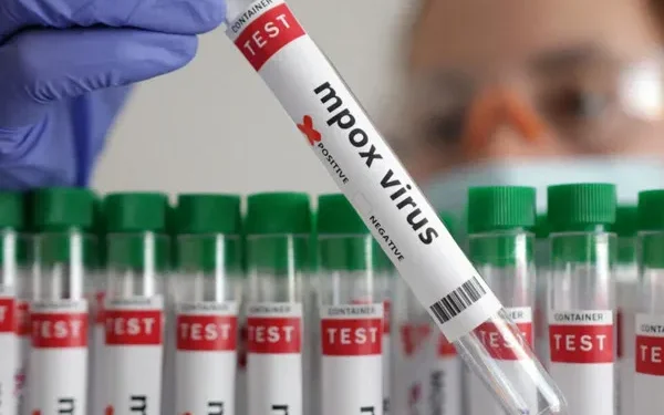 Insta ONU a fabricantes de vacunas a acelerar pruebas de Mpox